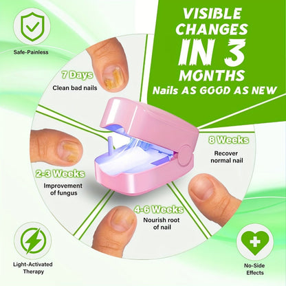 Nail Fungus Laser Treatment Device, FDA Cleared Anti-Fungal Laser for Toenail & Fingernail Fungal Infections