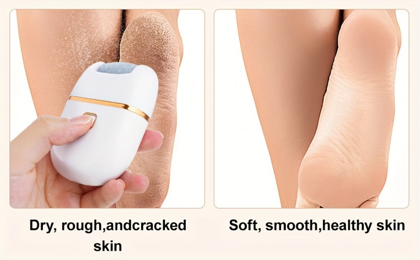 Electric Callus Remover Rechargeable Foot Grinder with 3 Replacement Heads 2 Speed Settings IPX5 Waterproof USB Charging Portable Pedicure