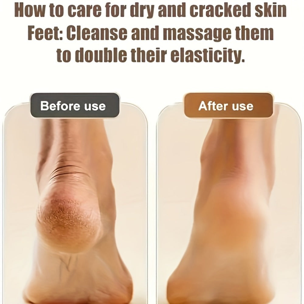 Electric Callus Remover Rechargeable Foot Grinder with 3 Replacement Heads 2 Speed Settings IPX5 Waterproof USB Charging Portable Pedicure