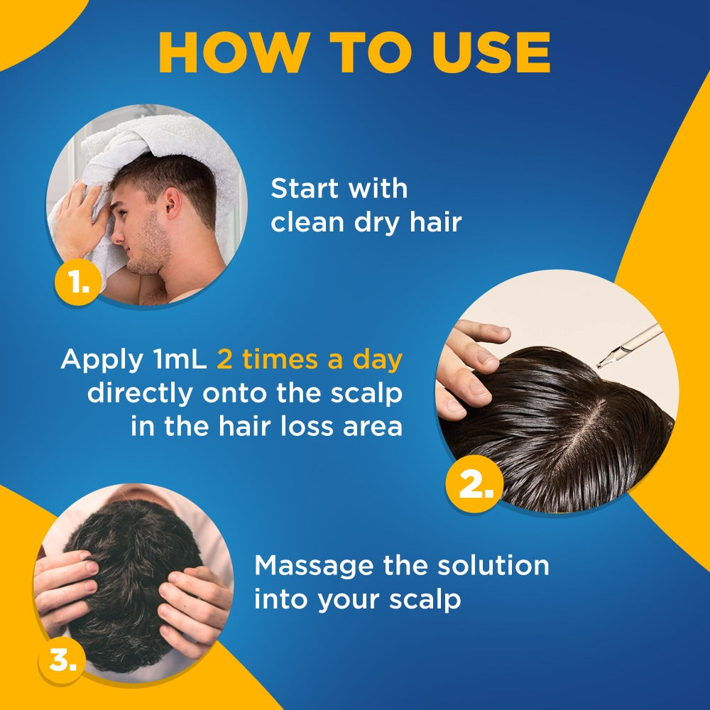 Minoxidil 5% Extra Strength Topical Solution for Men Hair Regrowth - Kirkland Signature 6-Month Supply