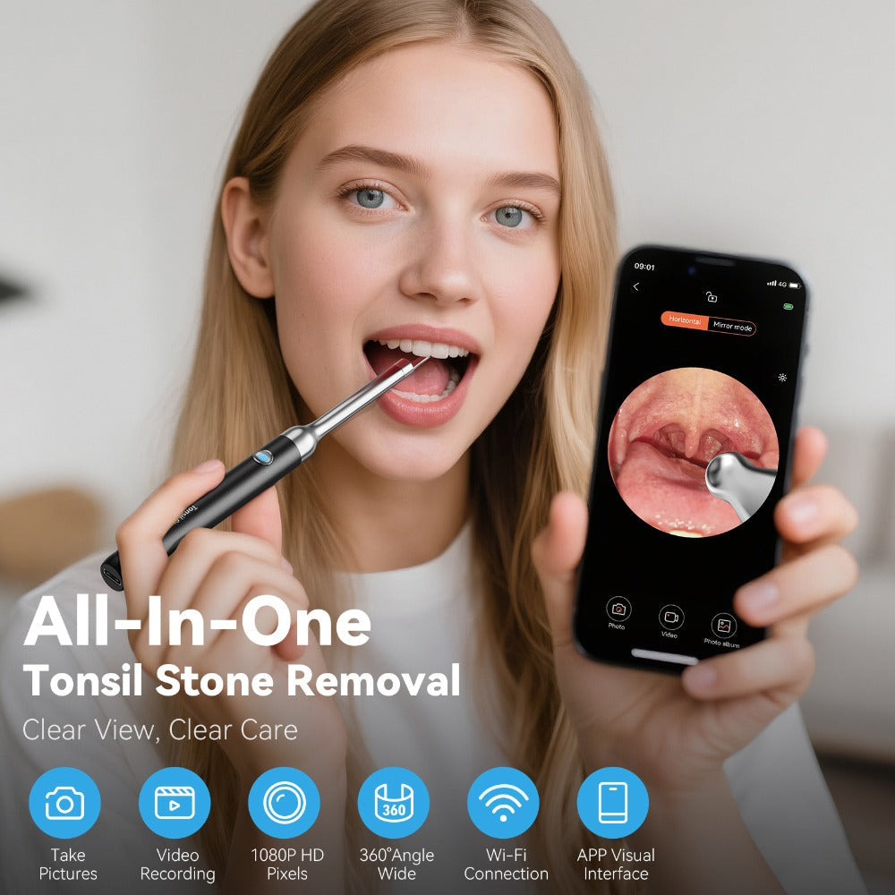 Tonsil Stone Remover with Camera 1080P HD Visual Oral Care Kit - 6 LED Lights, 5 Stainless Steel Tips