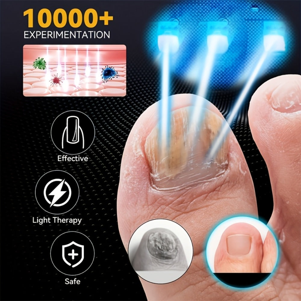 Nail Fungus Treatment Device, FDA Cleared Light Therapy for Toenails & Fingernails for Home and Salon Manicures