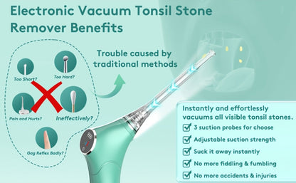 Tonsil Stone Remover Electric Vacuum Kit, Built-In LED Light, 3 Suction Modes & 5X Magnifying Mirror, Oral