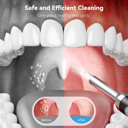 Intelligent Visual Tonsil Stone Removal Kit – 1080P HD Camera, 6 LED Lights, Wi-Fi & App Connection, Multi-Accessory Oral Inspection Tool
