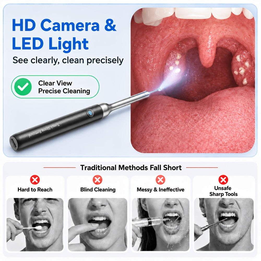 Tonsil Stone Remover with Camera - 1080P HD Visual Tonsil Stone Removal Tool with LED Light, 5-in-1 Stainless Steel Tips