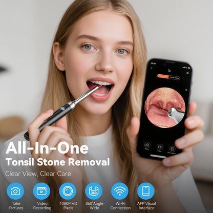 Intelligent Visual Tonsil Stone Removal Kit – 1080P HD Camera, 6 LED Lights, Wi-Fi & App Connection, Multi-Accessory Oral Inspection Tool