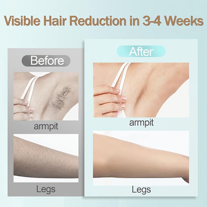 IPL Hair Removal Device Sapphire Ice Cooling Painless 999900 Flashes 9 Modes – At-Home Permanent Hair Reduction for Women Men Face Body