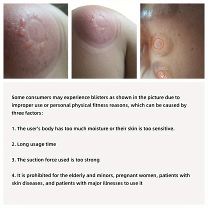 Electric Cupping Massage Device with Remote Control, Neck Back Waist Shoulder Massager, 3 Modes, Hot Compress Therapy
