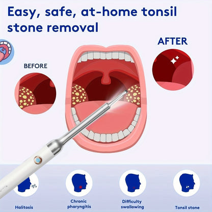 Visual Tonsil Stone Remover with 1080P HD Camera – 6 LED Lights, 5 Stainless Steel Heads, Bad Breath Prevention, iOS & Android Compatible