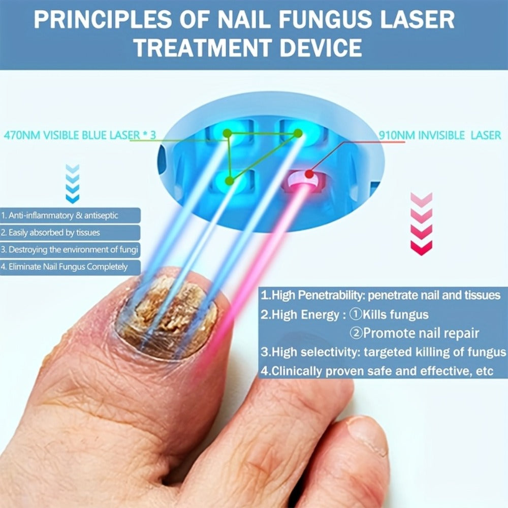 KTS Nail Fungus Laser Device FDA Cleared, Extra Strength 407nm Blue Light & 905nm Dual-Light Treatment for Toenail & Fingernail Fungus