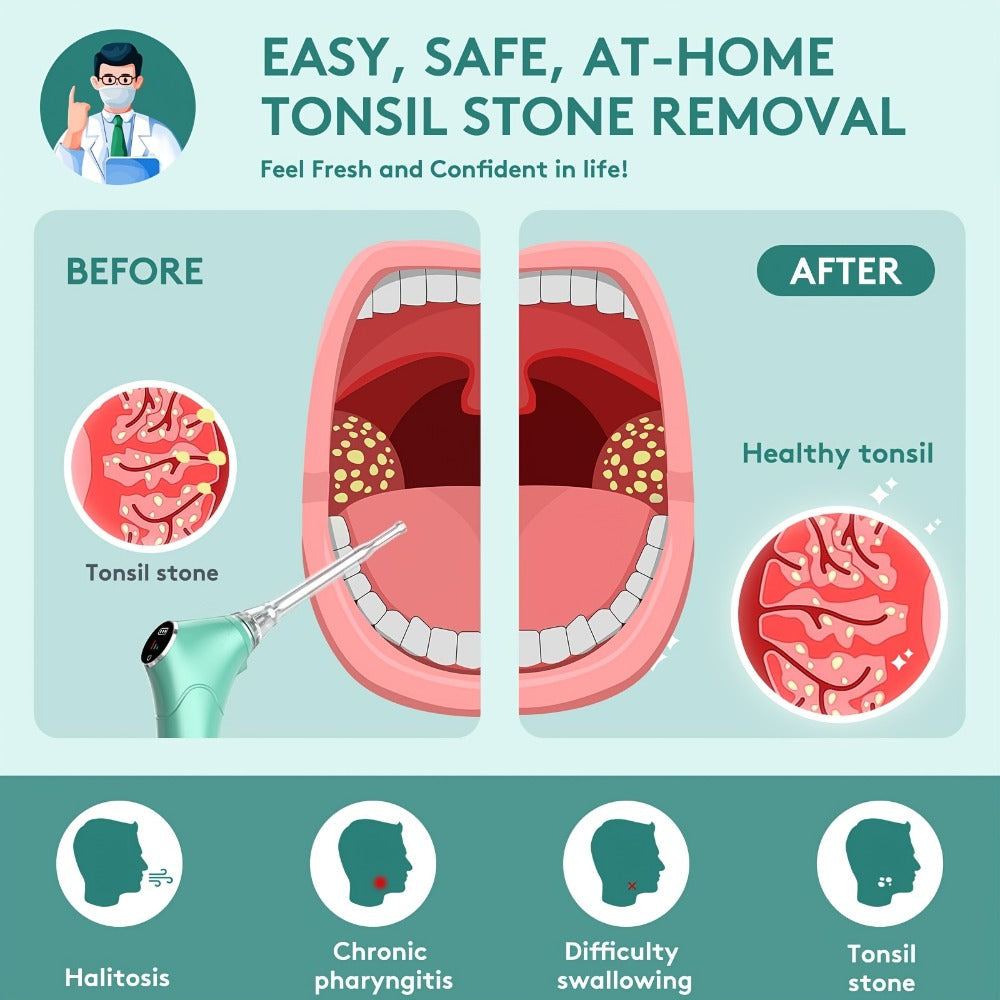Tonsil Stone Remover Electric Vacuum Kit, Built-In LED Light, 3 Suction Modes & 5X Magnifying Mirror, Oral