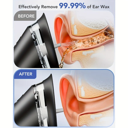 Earwax Removal Kit Pro with Visual Waste Tank, Interchangeable Nozzles, USB Rechargeable Ear Cleaner for Adults
