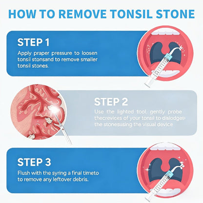 Tonsil Stone Remover with Camera 1080P HD Visual Oral Care Kit - 6 LED Lights, 5 Stainless Steel Tips
