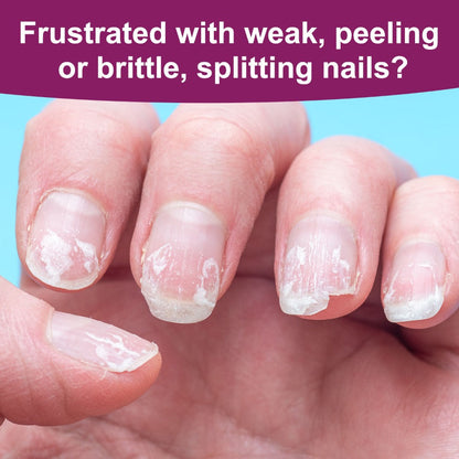 Nail Fortifier & Hardener 10ml Protective Strengthening Agent for Weak Damaged Brittle Nails – Makes Nails Stronger Tougher & Resilient