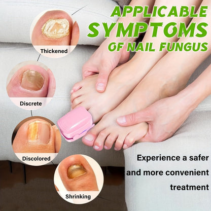 Nail Fungus Laser Treatment Device, FDA Cleared Anti-Fungal Laser for Toenail & Fingernail Fungal Infections