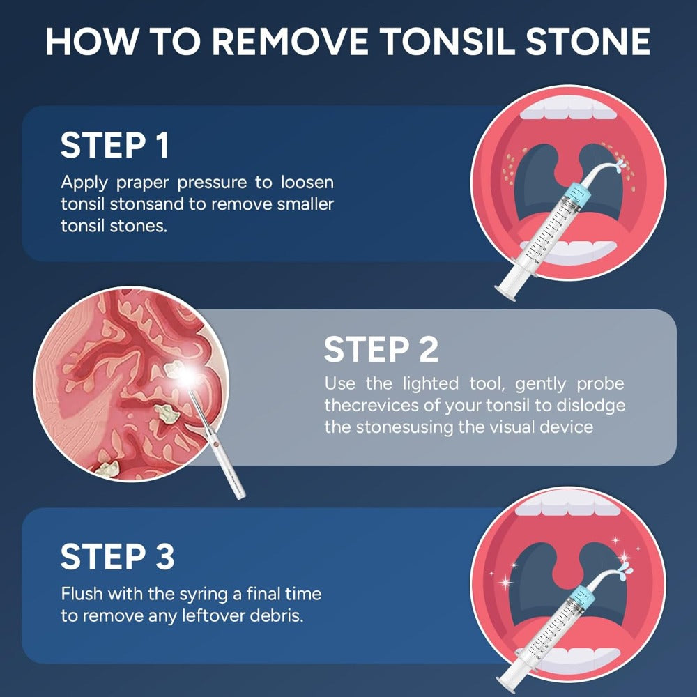 Visual Tonsil Stone Remover with 1080P HD Camera – 6 LED Lights, 5 Stainless Steel Heads, Bad Breath Prevention, iOS & Android Compatible