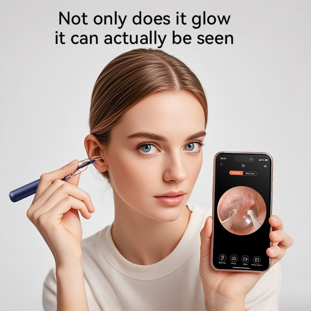 Upgraded 1080P Ear Wax Removal Tool with Camera & Storage Case – LED Light, iOS & Android Compatible, Complete Ear Cleaning Kit