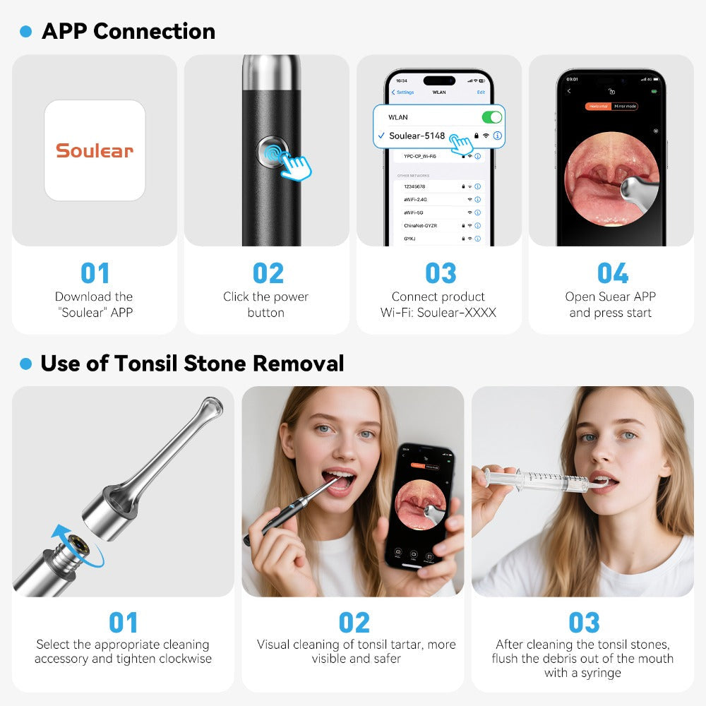 Tonsil Stone Remover with Camera 1080P HD Visual Oral Care Kit - 6 LED Lights, 5 Stainless Steel Tips