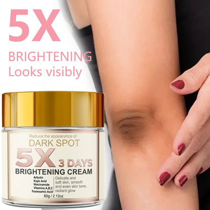 Kojic Acid Cream for Dark Spots – Skin Brightening Face Cream with Vitamin C, Arbutin & Niacinamide, Fades Hyperpigmentation Dullness Uneven
