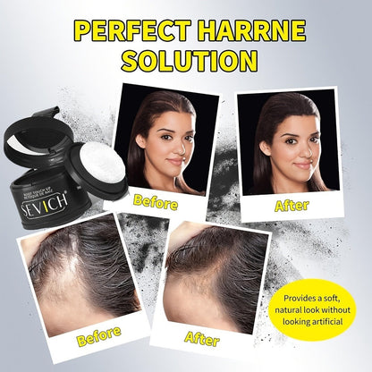 Hair Loss Cover Powder Hairline Concealer for Thinning Hair & Bald Spots – Volumizing Root Touch Up Scalp Powder