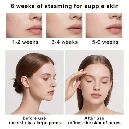 Facial Steamer Nano Ion Mist – Deep Pore Cleansing Home Spa Face Steamer with 360° Rotatable Arm, Blackhead Remover