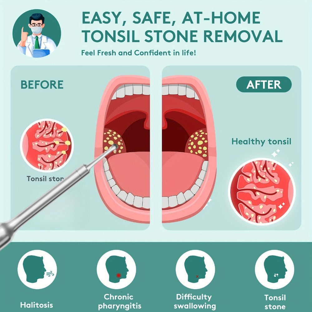 Visual Tonsil Stone Remover with 1080P HD Camera – 6 LED Lights, 5 Stainless Steel Heads, Bad Breath Prevention, iOS & Android Compatible