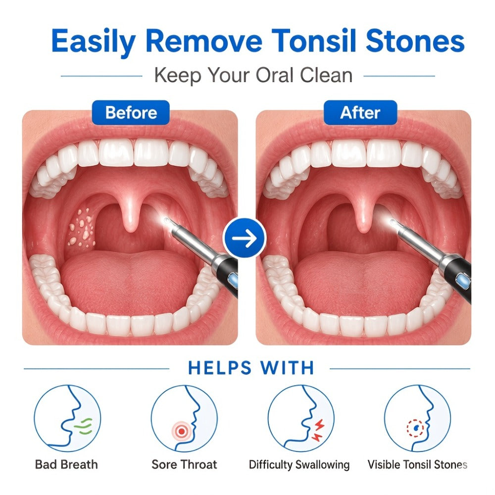 Tonsil Stone Remover with Camera - 1080P HD Visual Tonsil Stone Removal Tool with LED Light, 5-in-1 Stainless Steel Tips