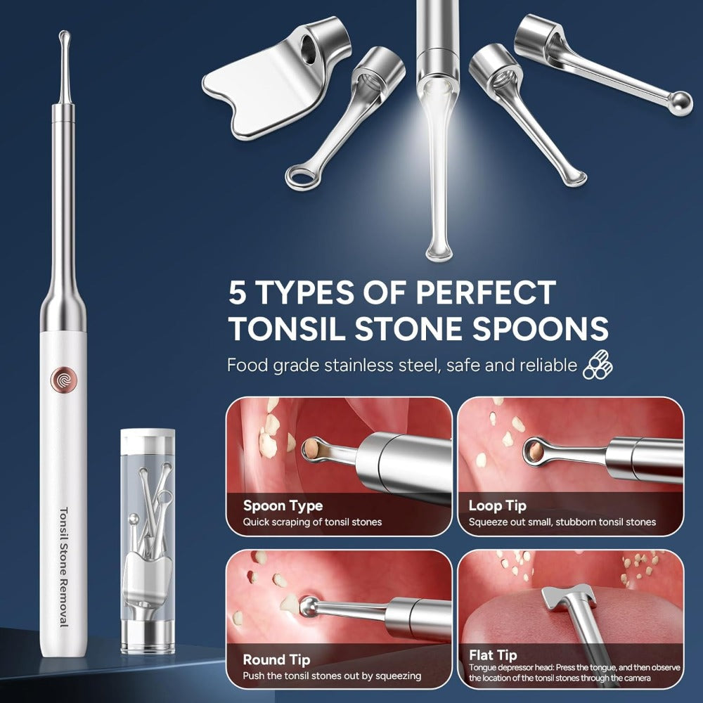 Visual Tonsil Stone Remover with 1080P HD Camera – 6 LED Lights, 5 Stainless Steel Heads, Bad Breath Prevention, iOS & Android Compatible