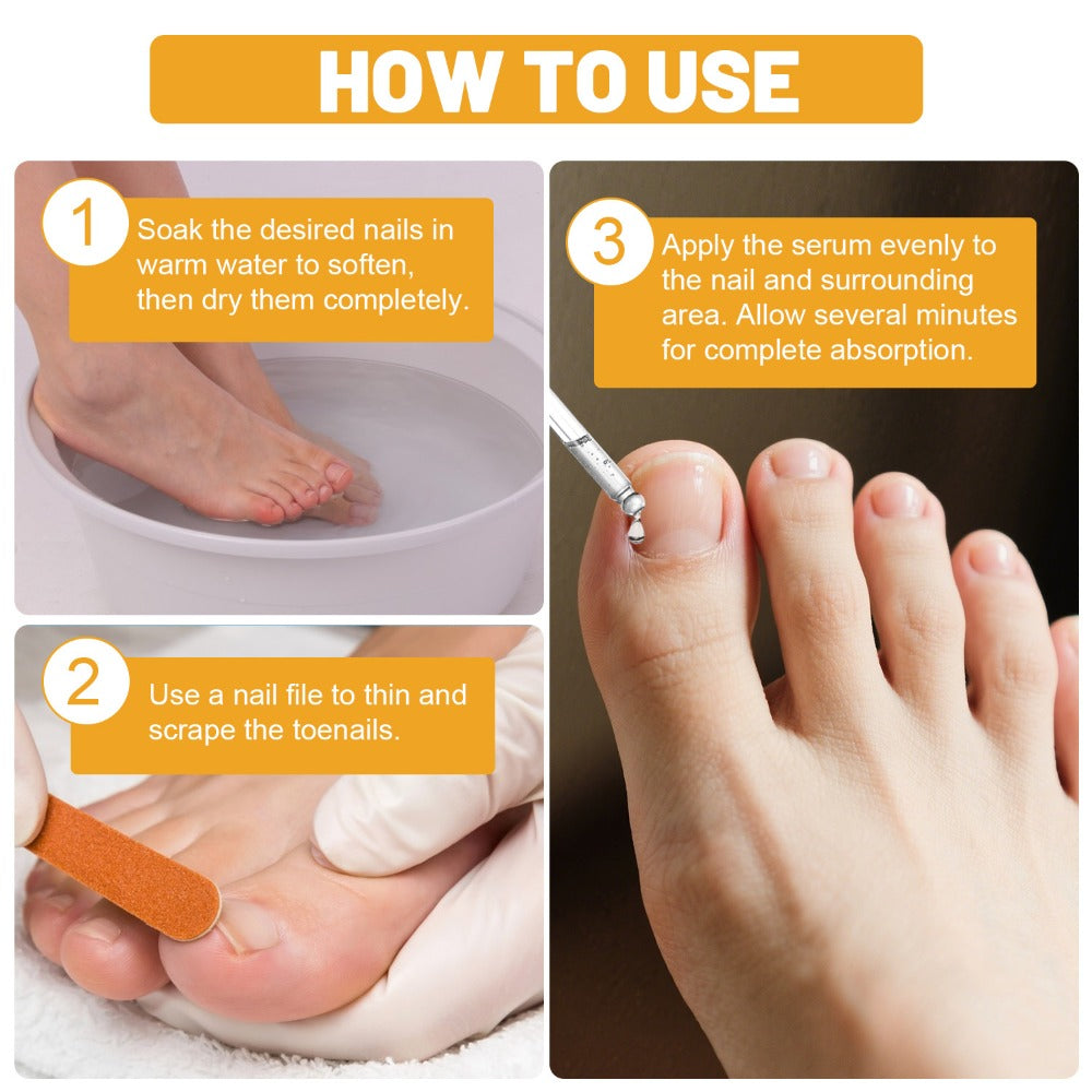 Bee Venom Toenail Serum 30ml in a Single Bottle for a Simple Nail Care and Grooming Routine