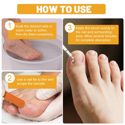 Bee Venom Toenail Serum 30ml in a Single Bottle for a Simple Nail Care and Grooming Routine