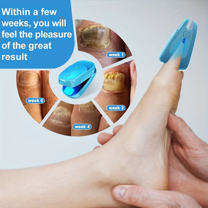 KTS Nail Fungus Laser Device FDA Cleared, Extra Strength 407nm Blue Light & 905nm Dual-Light Treatment for Toenail & Fingernail Fungus