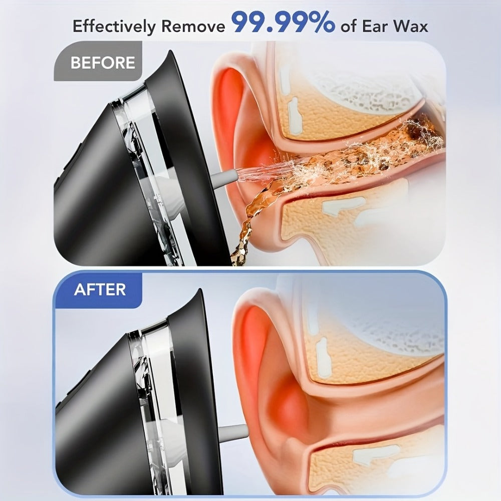 Electric Ear Cleaning System Professional Edition 3-Speed Hydraulic – Visual Waste Tank, Ear Dryer, USB Charging, Dry Dirty Storage