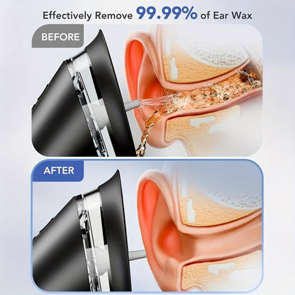 Electric Ear Cleaning System Professional Edition 3-Speed Hydraulic – Visual Waste Tank, Ear Dryer, USB Charging, Dry Dirty Storage