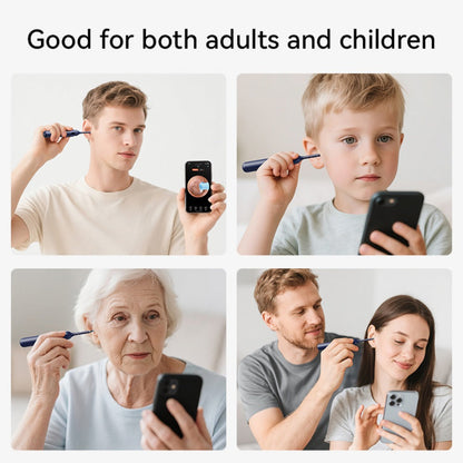 Upgraded 1080P Ear Wax Removal Tool with Camera & Storage Case – LED Light, iOS & Android Compatible, Complete Ear Cleaning Kit