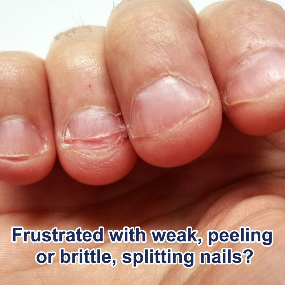 Nail Strengthening Kit 5-in-1 Formaldehyde-Free, Top Coat, Base Coat, Nail Hardener, Cuticle Oil & Polish