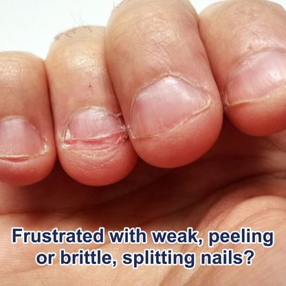 Nail Strengthening Kit 5-in-1 Formaldehyde-Free, Top Coat, Base Coat, Nail Hardener, Cuticle Oil & Polish