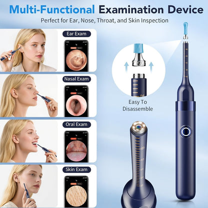 Upgraded 1080P Ear Wax Removal Tool with Camera & Storage Case – LED Light, iOS & Android Compatible, Complete Ear Cleaning Kit