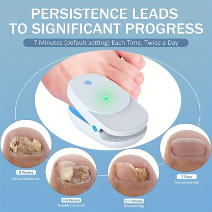 KTS Nail Fungus Laser Device FDA Cleared, Extra Strength 407nm Blue Light & 905nm Dual-Light Treatment for Toenail & Fingernail Fungus